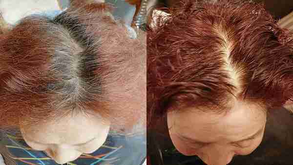 植物染发和普通染发有什么区别？四五十岁白发多适合染哪种？